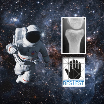BES TEST: la tecnologia italiana per diagnosticare la fragilità ossea è già pronta a partire per lo spazio.